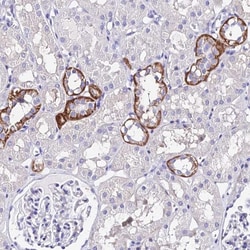 METTL19 Antibody, Novus Biologicals 0.1mL; Unlabeled:Antibodies, Polyclonal